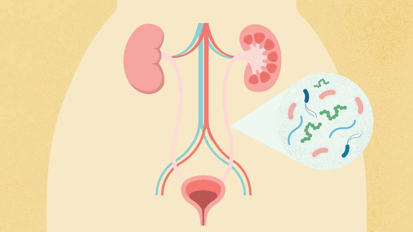 how do you get a uti